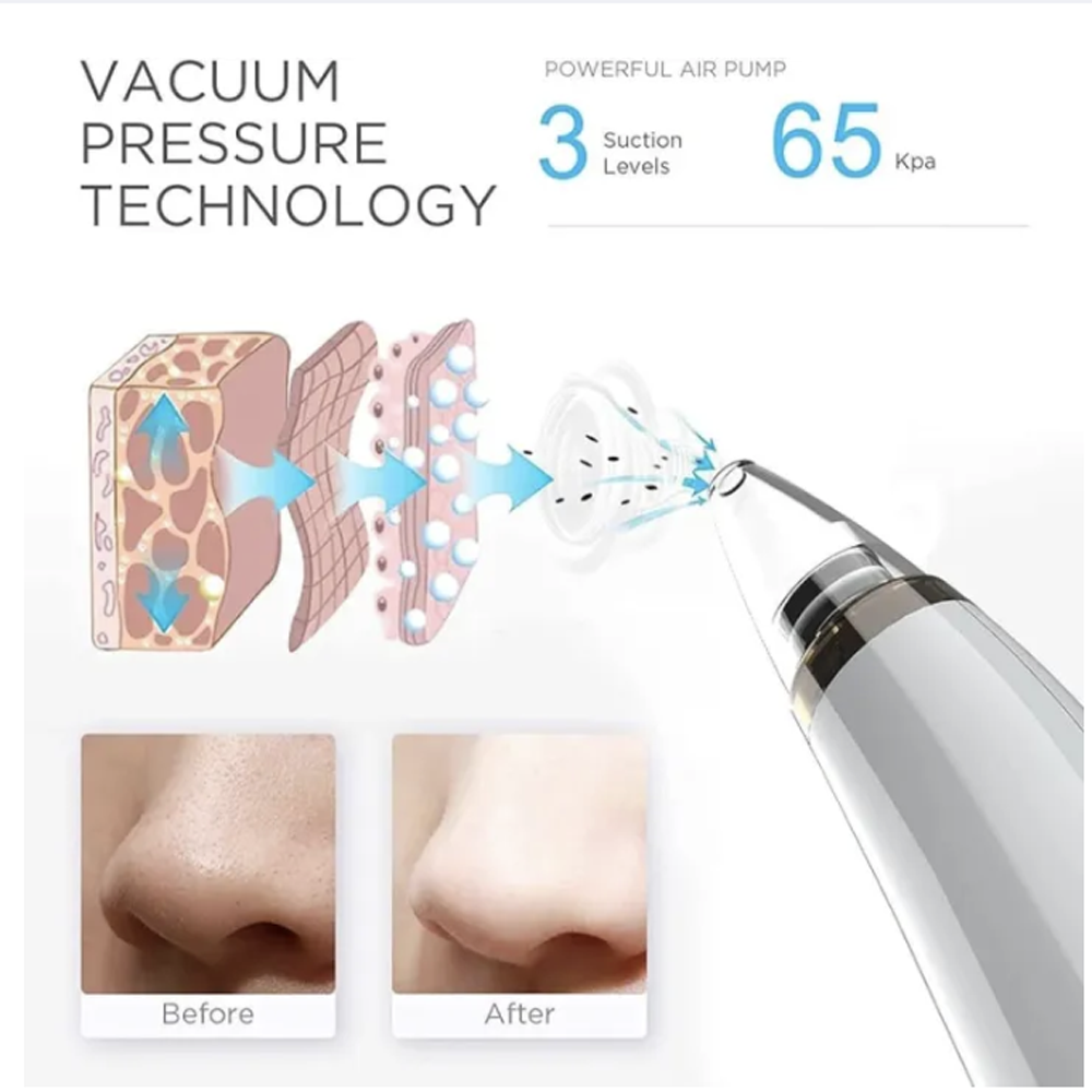 Derma Suction 6 in 1 Blackhead Acne and Nose Pore Removal Machine Rechargeable